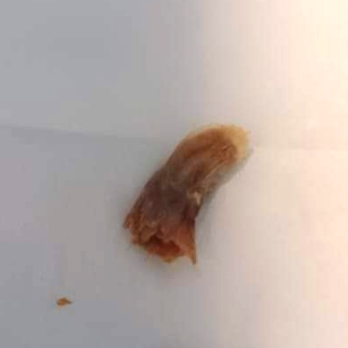 Ear Wax